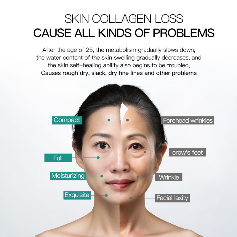 Type lll collagen solution Serum  5mlx10