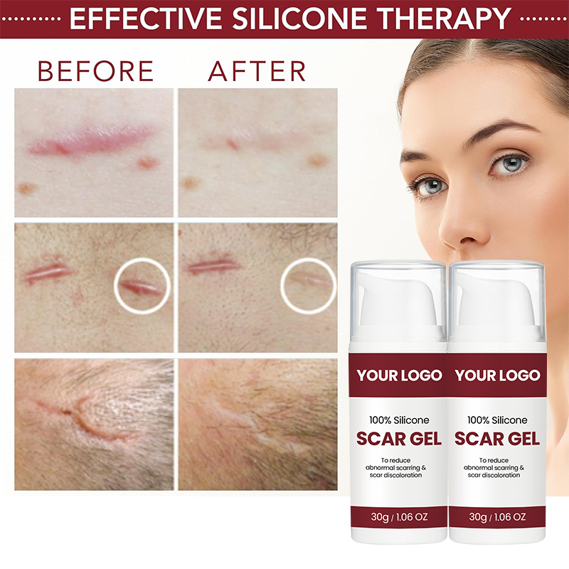 MULTI-PURPOSE USE, Reduction From Surgery, Injury, Acne, C-S