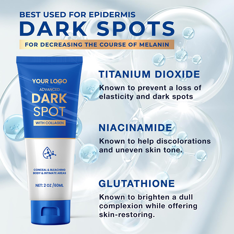 AgeSpots Sun Spots Freckles Melasma Brown Spots, Use on Face Hands Underarms and Legs, Dark Spot Remover for Face and Body cream(pic4)