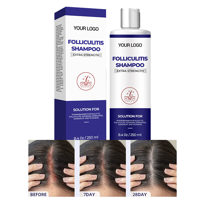 Organic Anti-Loss Biotin Hair Shampoo Nourishing Refreshing Formula Hair-Loss Prevention(pic2)
