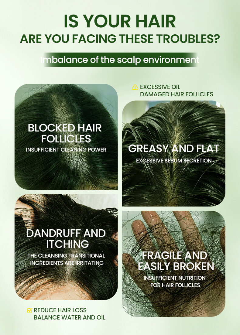 Customized Ushman Soap for Hair Growth Treatment | Natural & Organic Hair Care Soap(pic2)