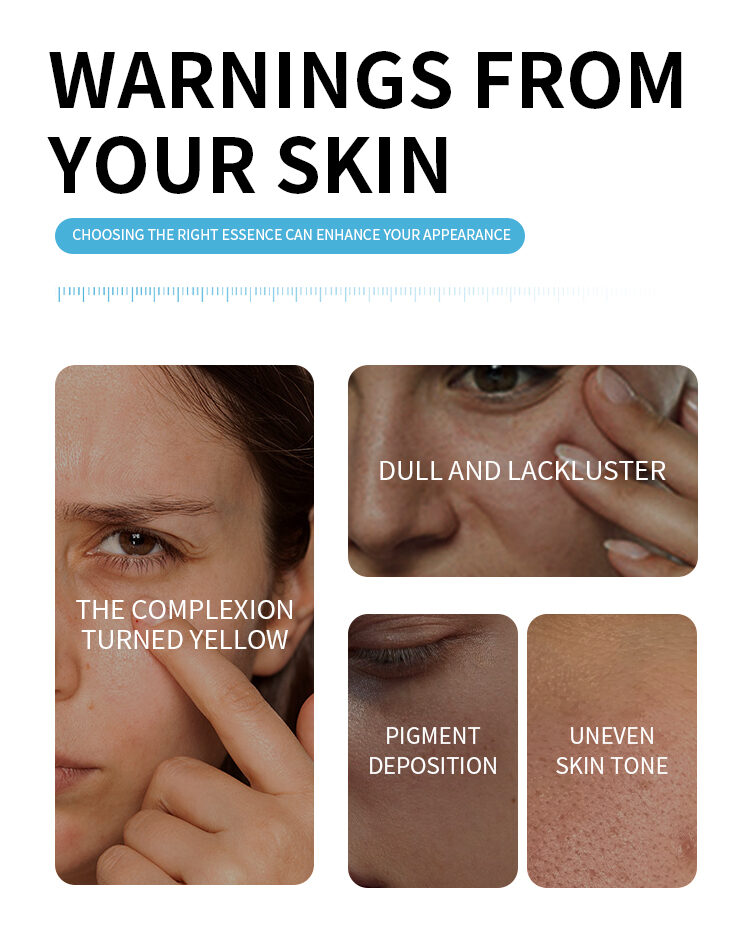 Custom B3 Niacinamide 10% Brightening Serum for Face, Anti-Aging Whitening Essence(pic3)