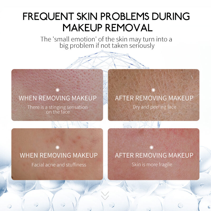 Freemadge Serum Protein Makeup Remover for Any Skin, Remove Makeup, gentle not to hurt the skin for Men and Women(pic2) Freemadge Serum Protein Makeup Remover for Any Skin, Remove Makeup, gentle not to hurt the skin for Men and Women(pic2)