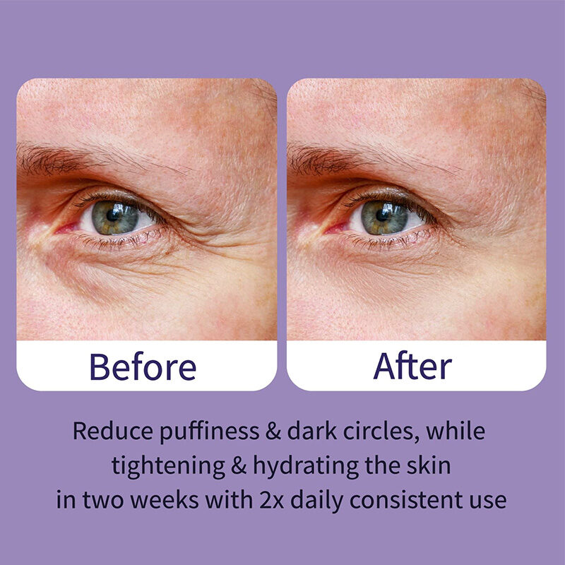 Peptide Eye Essence & Bag Removal Wrinkle Repair Firming Moisturizer(pic5)
