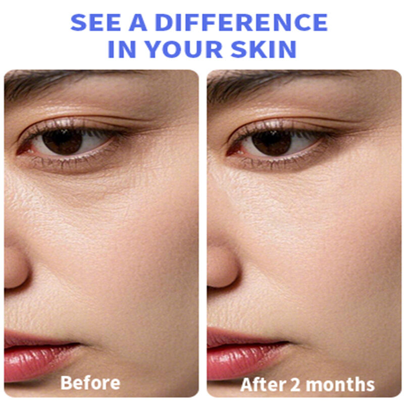 Private label yerba mate eye cream soothes eyes(pic5) Yerba Mate Wake up Eye Gel With Hyaluronic Acid, Caffeine for Hydrate, Minimize Puffiness, Swelling(pic5)