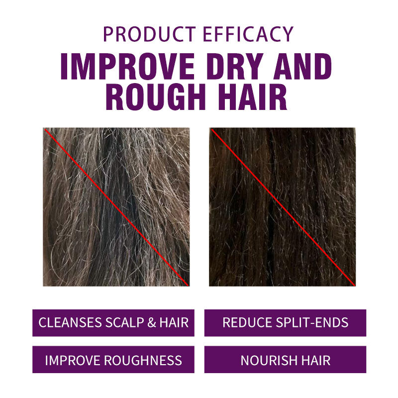 Agan Essential Oil Smooth Shampoo, Anti-Dandruff and Hair Loss Treatment Shampoo, Hair Conditioner, Skin Care Oil, Hair Mask(pic2)