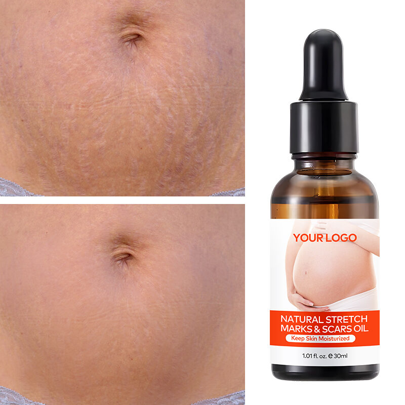 Wholesale Organic Postpartum Belly Texture Repair Skin Lubrication and Moisturizing Scar Healing Essential Oil(pic5)