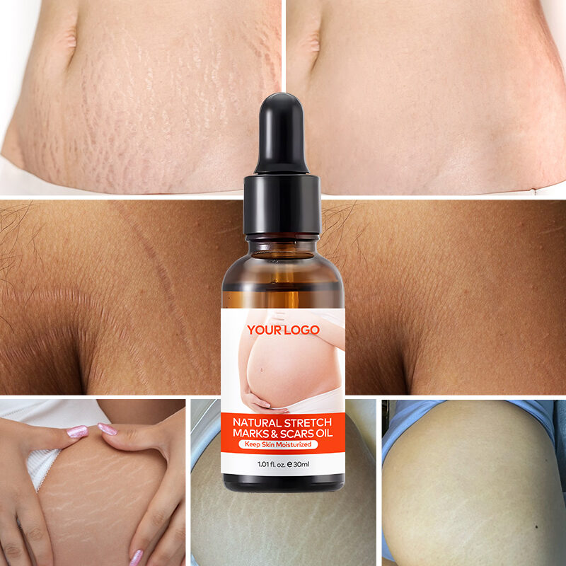 Wholesale Organic Postpartum Belly Texture Repair Skin Lubrication and Moisturizing Scar Healing Essential Oil(pic6)
