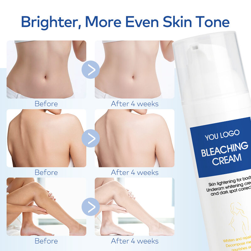 Fast Effect Hydra Whiten Lightening Body Cream for Intimate Areas Underarm Knees Elbow Bikini Line(pic4) Fast Effect Hydra Whiten Lightening Body Cream for Intimate Areas Underarm Knees Elbow Bikini Line(pic4)