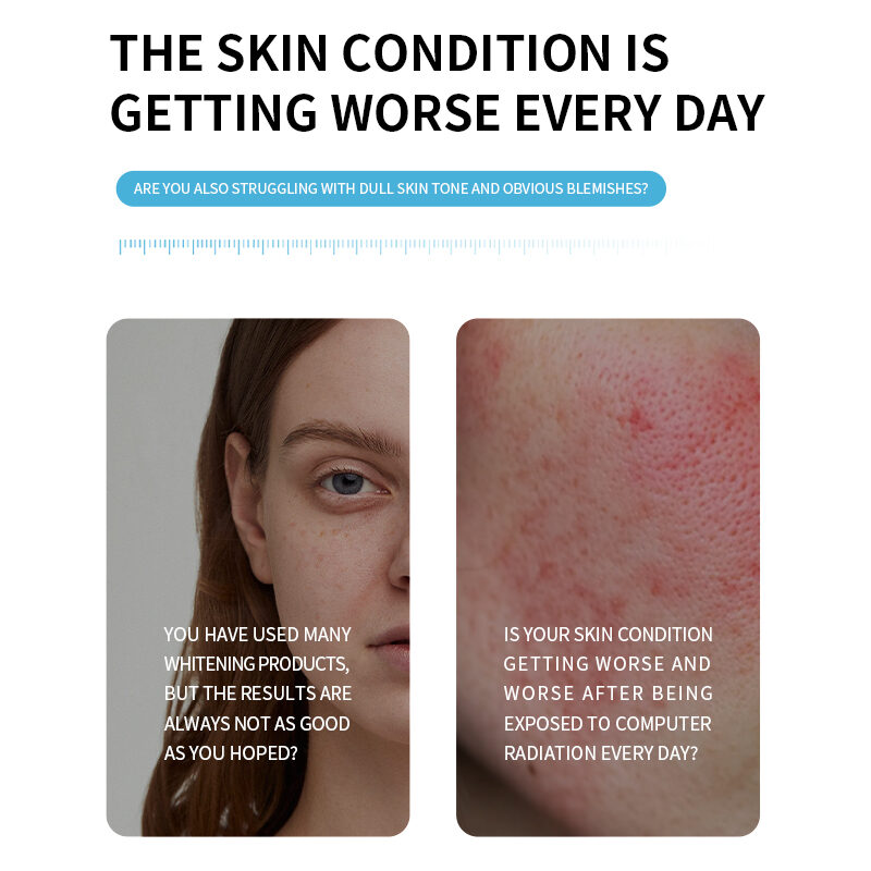 Niacinamide Brightening 3% Vitamin B3 Liquid Face Spray Whitening Serum Mist Dark Spot Correction Hydration OEM Cosmetic Bulk(pic3) Niacinamide Brightening 3% Vitamin B3 Liquid Face Spray Whitening Serum Mist Dark Spot Correction Hydration OEM Cosmetic Bulk(pic3)