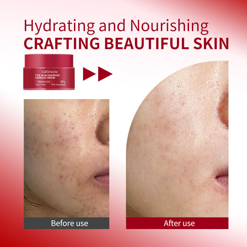 GreenLem 2026 New Arrival Skin Care Capsule for Series Hyaluronic Acid Liquid Facial Brightening Hydrating Radiance Serum(pic4)