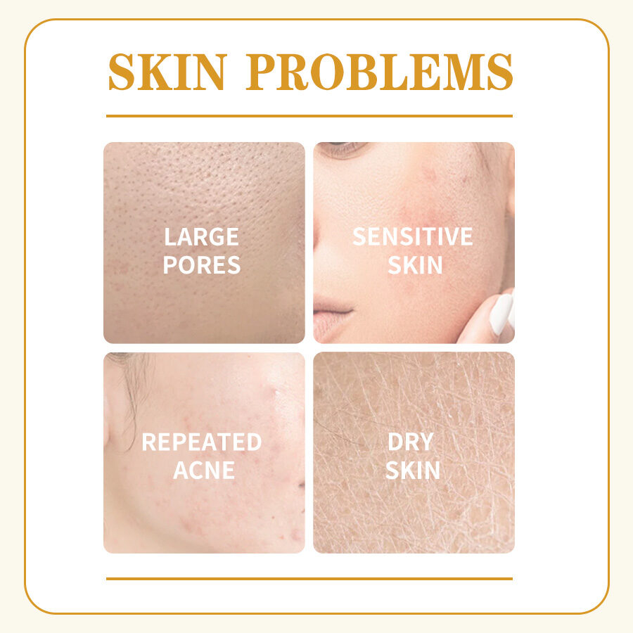 GreenLem Beauty Chamomile Masque Peel Sheet Lightening Facial for Combination Skin Moisturizing Face(pic2)